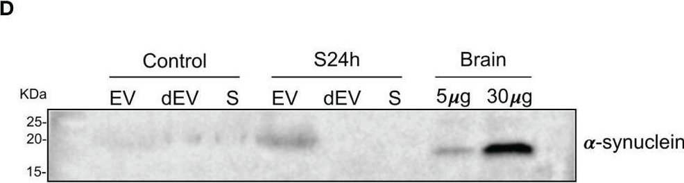 Fig.4.D showing Western Blotting from the publication: Surgical Trauma in Mice Modifies the Content of Circulating Extracellular Vesicles.
