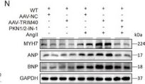 Fig.8.N showing Western Blotting from the publication: TRIM40 Drives Pathological Cardiac Hypertrophy and Heart Failure via Ubiquitination of PKN2.