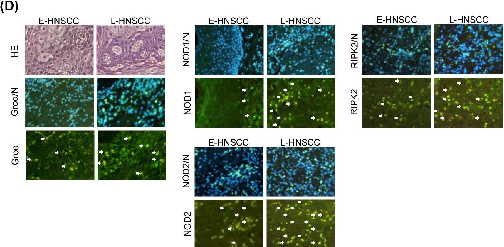 Fig.2.D showing Immunocytochemistry-immunofluorescence in a Homo sapiens (Human) sample from the publication: Growth Regulated Oncogene-α Upregulates TNF-α and COX-2 and Activates NOD1/RIPK2 mediated-MAPK Pathway in Head and Neck Squamous Cell Carcinoma.