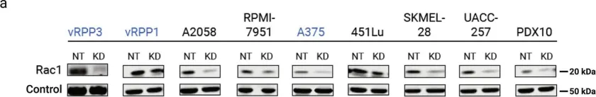 Fig.1.A showing Western Blotting from the publication: SRC-RAC1 signaling drives drug resistance to BRAF inhibition in de-differentiated cutaneous melanomas.