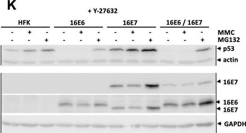 Fig.4.K showing Western Blotting in a Homo sapiens (Human) sample from the publication: Human papillomavirus type 16 E6 induces cell competition.