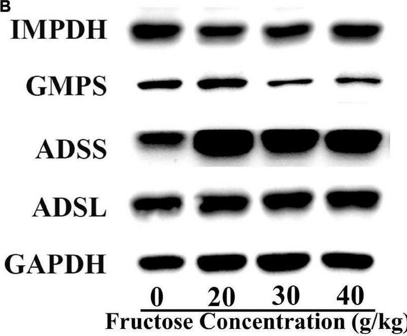 Fig.5.B showing Western Blotting from the publication: Dietary intake of fructose increases purine de novo synthesis: A crucial mechanism for hyperuricemia.