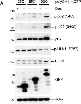 Proteotoxic stress induces phosphorylation of p62/SQSTM1 by ULK1 to regulate selective autophagic clearance of protein aggregates.