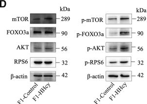 Fig.6.D showing Western Blotting from the publication: Maternal hyperhomocysteinemia compromises female offspring fertility through overactivation of primordial follicles.