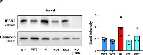 Fig.2.F showing Western Blotting in a Homo sapiens (Human) sample from the publication: A pleiotropic recurrent dominant ITPR3 variant causes a complex multisystemic disease.