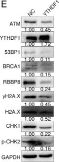 Fig.4.E showing Western Blotting in a Homo sapiens (Human) sample from the publication: N6-methyladenosine regulates ATM expression and downstream signaling.