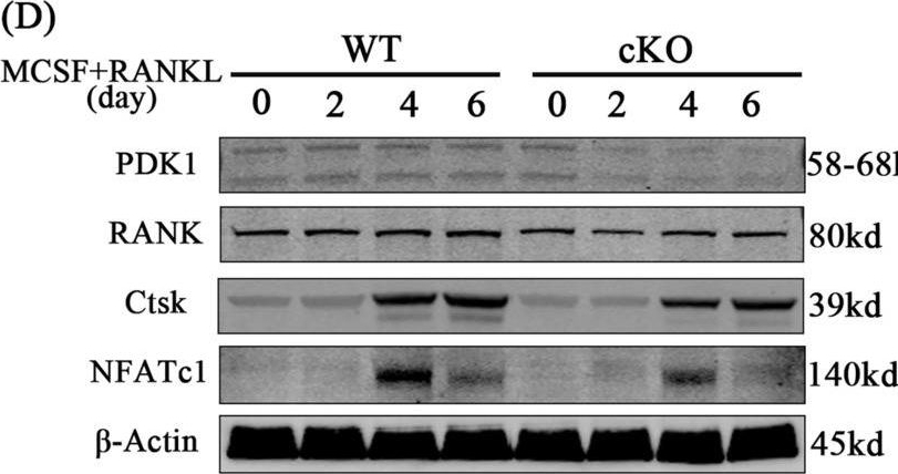 Fig.5.D showing Western Blotting in a Mus musculus (House mouse) sample from the publication: Conditional knockout of PDK1 in osteoclasts suppressed osteoclastogenesis and ameliorated prostate cancer-induced osteolysis in murine model.
