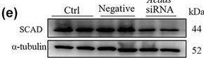 Fig.4.E showing Western Blotting from the publication: Aging-induced short-chain acyl-CoA dehydrogenase promotes age-related hepatic steatosis by suppressing lipophagy.