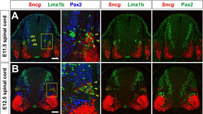 Fig.6.A showing Immunohistochemistry-immunofluorescence in a Mus musculus (House mouse) sample from the publication: Investigating the basis of lineage decisions and developmental trajectories in the dorsal spinal cord through pseudotime analyses.