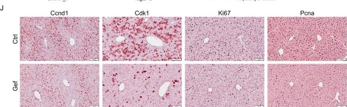 Fig.1.J showing Immunohistochemistry from the publication: Targeting Egfr-Mediated Cell Proliferation and Lipid Metabolism Separation Effectively Accelerate Liver Regeneration.