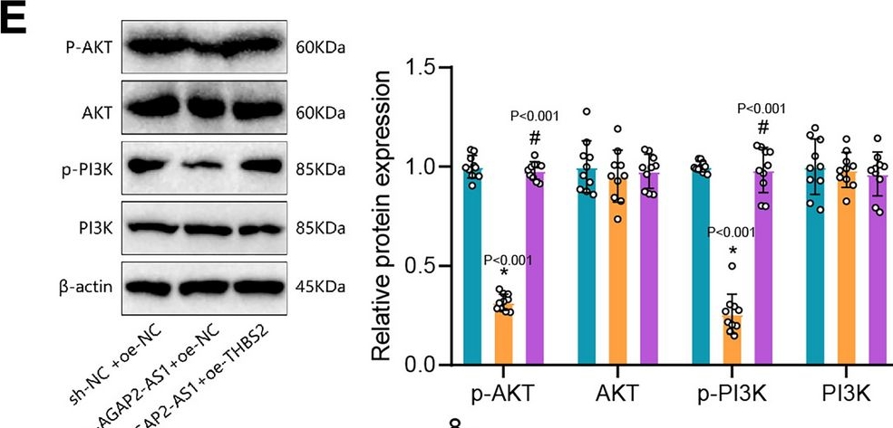 Fig.6.E showing Western Blotting from the publication: LncRNA AGAP2 antisense RNA 1 stabilized by insulin-like growth factor 2 mRNA binding protein 3 promotes macrophage M2 polarization in clear cell renal cell carcinoma through regulation of the microRNA-9-5p/THBS2/PI3K-Akt pathway.