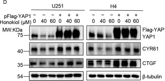 Fig.4.D showing Western Blotting from the publication: Honokiol Suppresses Glioma Cell Proliferation by Disrupting SUMO1-YAP1 Conjugation and Promoting YAP1 Proteasomal Degradation.