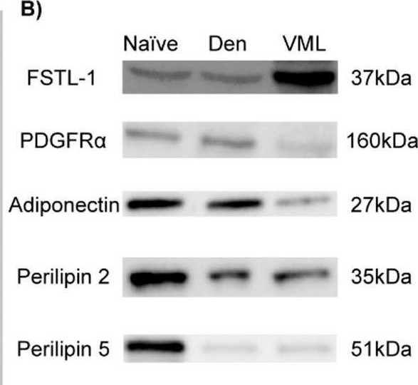 Fig.6.B showing Western Blotting from the publication: Accumulation of lipids after acute direct and indirect traumatic injuries in male and female mice.