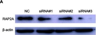 Fig.4.A showing Western Blotting from the publication: The Suppression of miR-199a-3p by Promoter Methylation Contributes to Papillary Thyroid Carcinoma Aggressiveness by Targeting RAP2a and DNMT3a.