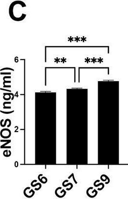 Fig.1.C showing Enzyme-linked immunosorbent assay from the publication: S-nitrosylation of CSF1 receptor increases the efficacy of CSF1R blockage against prostate cancer.