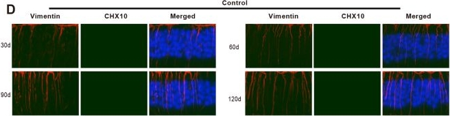 Fig.1.D showing Immunocytochemistry-immunofluorescence in a Rattus norvegicus (Rat) sample from the publication: Human embryonic stem cell-derived extracellular vesicles alleviate retinal degeneration by upregulating Oct4 to promote retinal Müller cell retrodifferentiation via HSP90.