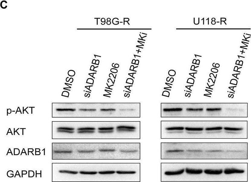 Fig.3.C showing Western Blotting in a Homo sapiens (Human) sample from the publication: Aberrant Expression of ADARB1 Facilitates Temozolomide Chemoresistance and Immune Infiltration in Glioblastoma.