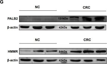 Fig.9.G showing Western Blotting from the publication: Prognostic value and experimental validation of atherosclerosis-derived pathogenic genes in colorectal cancer.