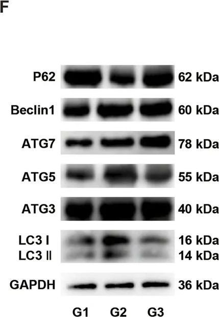 Fig.7.F showing Western Blotting from the publication: Genkwanin mitigates renal fibrosis by reprogramming profibrotic signaling and restoring TFEB-mediated autophagy.