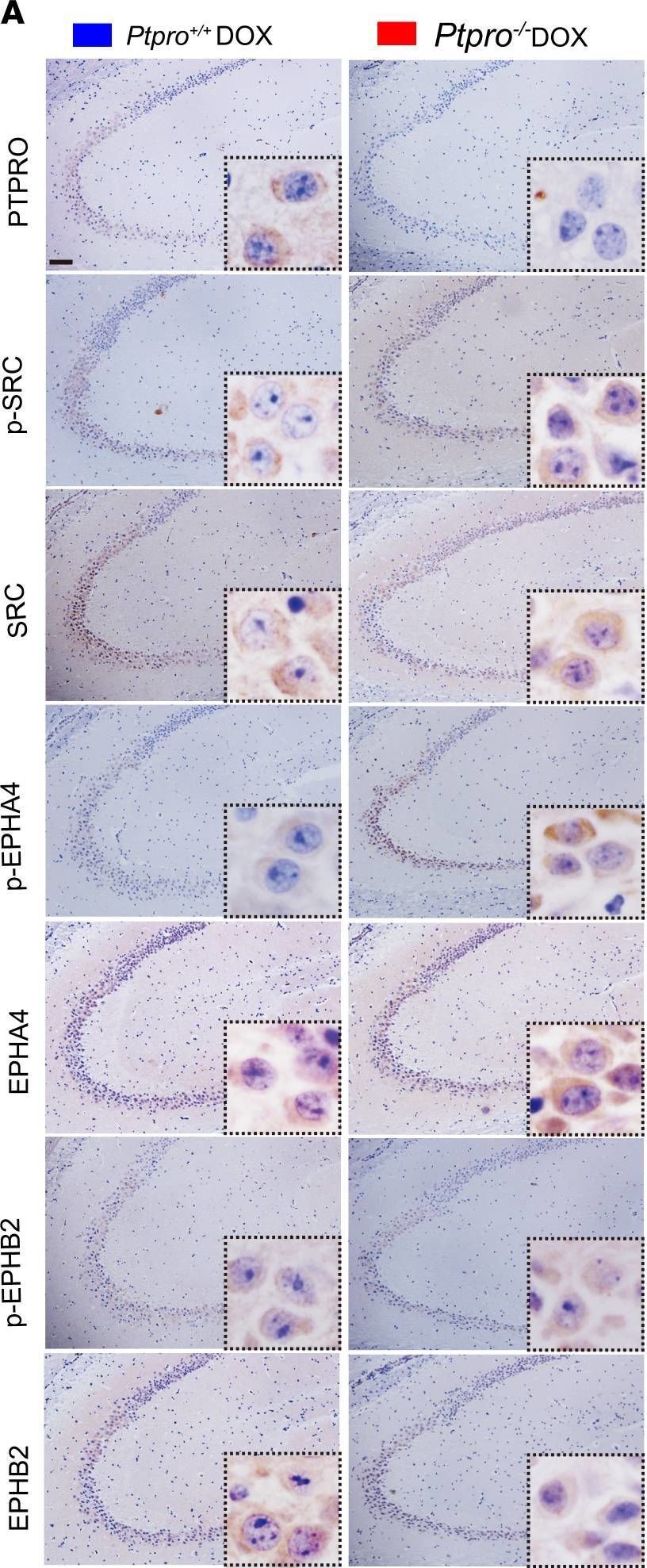 Fig.6.A showing Immunohistochemistry from the publication: Age-related decline in hippocampal tyrosine phosphatase PTPRO is a mechanistic factor in chemotherapy-related cognitive impairment.