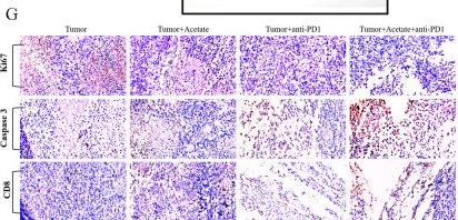 Fig.7.G showing Immunohistochemistry from the publication: Gut-derived Faecalibaculum rodentium exerts anti-cancer effects on colorectal cancer by modulating PDPN-CLEC-2 signaling pathway.