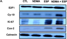 Fig.2.A showing Western Blotting in a Rattus norvegicus (Rat) sample from the publication: Connexin 43 plays an important role in the transformation of cholangiocytes with Clonochis sinensis excretory-secretory protein and N-nitrosodimethylamine.