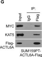 Fig.2.G showing Western Blotting from the publication: Actin-like protein 6A/MYC/CDK2 axis confers high proliferative activity in triple-negative breast cancer.