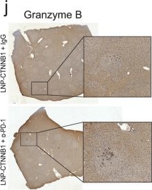 Fig.7.J showing Immunohistochemistry from the publication: Precision targeting of β-catenin induces tumor reprogramming and immunity in hepatocellular cancers.
