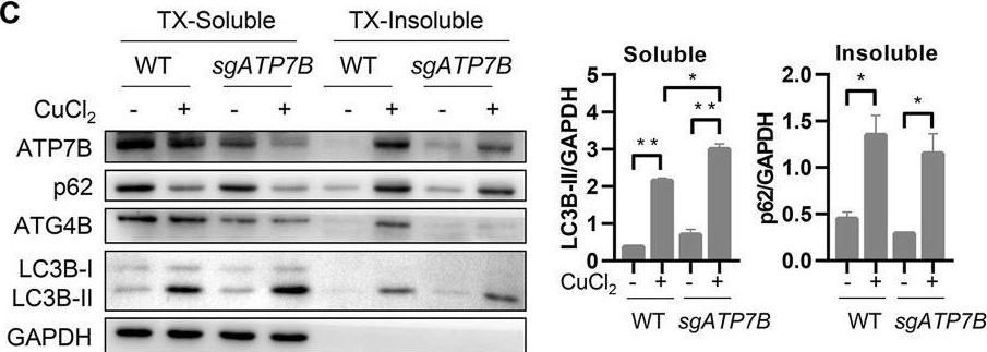 Fig.7.C showing Western Blotting in a Homo sapiens (Human) sample from the publication: Suppression of ATG4B by copper inhibits autophagy and involves in Mallory body formation.