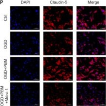 Fig.7.P showing Immunocytochemistry-immunofluorescence in a Mus musculus (House mouse) sample from the publication: Photobiomodulation repairs the blood-spinal cord barrier in a mouse model of spinal cord injury.