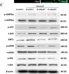 Fig.6.C showing Western Blotting from the publication: Effects of Cilostazol on Angiogenesis in Diabetes through Adiponectin/Adiponectin Receptors/Sirtuin1 Signaling Pathway.