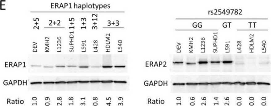 Fig.1.E showing Western Blotting from the publication: Interaction between ERAP Alleles and HLA Class I Types Support a Role of Antigen Presentation in Hodgkin Lymphoma Development.