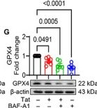Fig.4.G showing Western Blotting in a HIV sample from the publication: HIV Tat-Stimulated Microglial Extracellular Vesicles Are Enriched for Ferroptosis Mediators: Role of Dysregulated Autophagy.