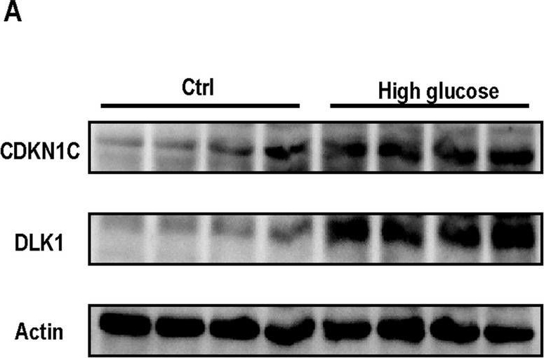 Fig.8.A showing Western Blotting in a Homo sapiens (Human) sample from the publication: Identification and validation of core genes for type 2 diabetes mellitus by integrated analysis of single-cell and bulk RNA-sequencing.