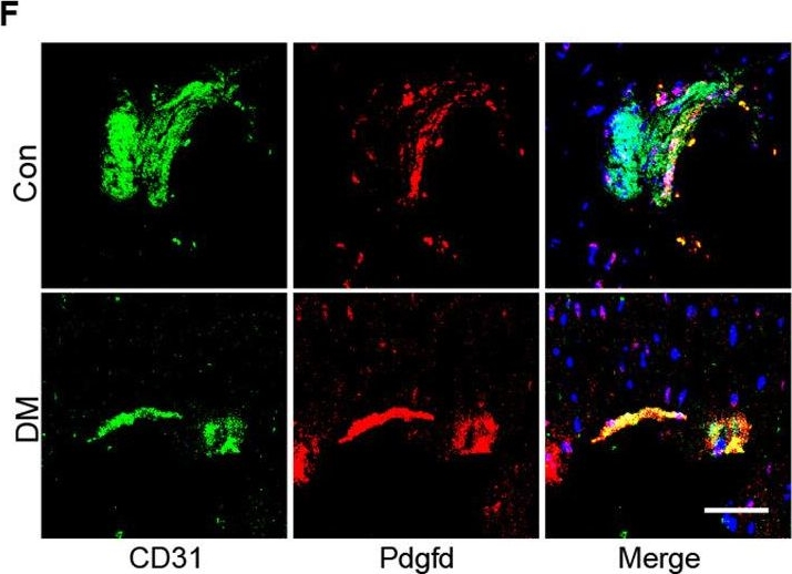 Fig.3.F showing Immunohistochemistry-immunofluorescence in a Mus musculus (House mouse) sample from the publication: Single-cell RNA-seq of heart reveals intercellular communication drivers of myocardial fibrosis in diabetic cardiomyopathy.