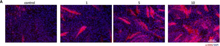 Fig.1.A showing Immunohistochemistry-immunofluorescence in a Mus musculus (House mouse) sample from the publication: The effects of TGF-β receptor I inhibitors on myofibroblast differentiation and myotube formation.