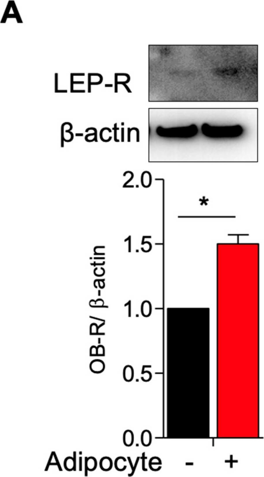 Fig.2.A showing Western Blotting from the publication: Obesity Contributes to Transformation of Myometrial Stem-Cell Niche to Leiomyoma via Inducing Oxidative Stress, DNA Damage, Proliferation, and Extracellular Matrix Deposition.