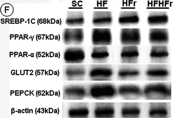 Fig.3.F showing Western Blotting in a Mus musculus (House mouse) sample from the publication: Hepatic adverse effects of fructose consumption independent of overweight/obesity.