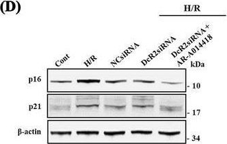 Fig.6.D showing Western Blotting from the publication: Decoy Receptor 2 as a Cell Cycle Arrest Biomarker for Predicting Renal Recovery Following Acute Kidney Injury.