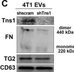 Fig.6.C showing Western Blotting from the publication: Transglutaminase-2 facilitates extracellular vesicle-mediated establishment of the metastatic niche.