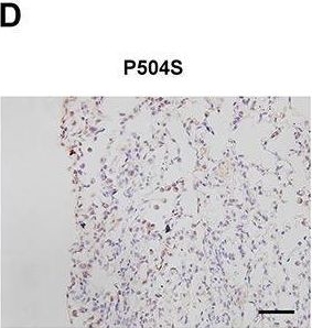 Fig.4.D showing Immunohistochemistry from the publication: SMARCC1 Suppresses Tumor Progression by Inhibiting the PI3K/AKT Signaling Pathway in Prostate Cancer.