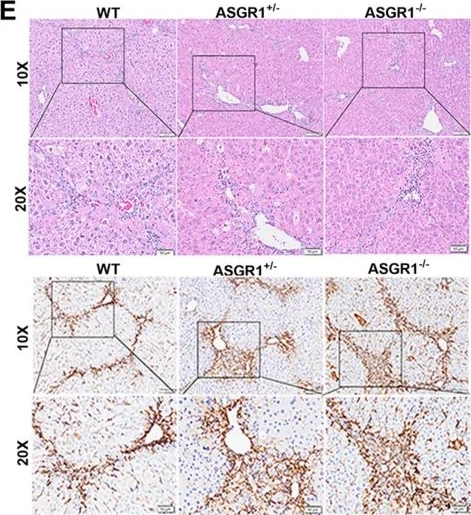 Fig.2.E showing Immunohistochemistry from the publication: ASGR1 Deficiency Promotes Liver Fibrosis by Enhancing Pro-Inflammatory Arachidonic Acid Metabolism and ALP Secretion.
