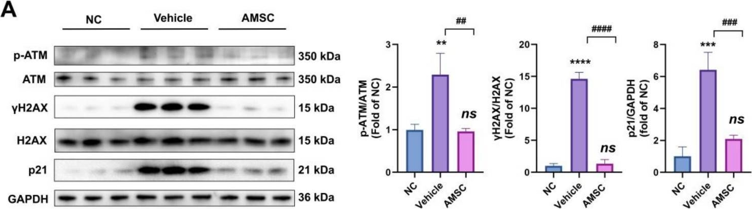 Fig.8.A showing Western Blotting from the publication: Adipose-Derived Mesenchymal Stem Cells Inhibit JNK-Mediated Mitochondrial Retrograde Pathway to Alleviate Acetaminophen-Induced Liver Injury.