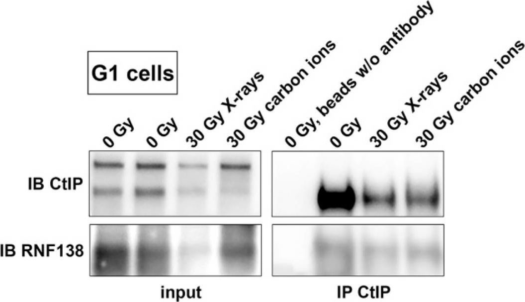 Fig.5.A showing Western Blotting in a Homo sapiens (Human) sample from the publication: The Ubiquitin Ligase RNF138 Cooperates with CtIP to Stimulate Resection of Complex DNA Double-Strand Breaks in Human G1-Phase Cells.
