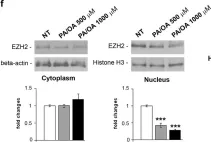 Fig.2.M showing Western Blotting from the publication: EZH2 down-regulation exacerbates lipid accumulation and inflammation in in vitro and in vivo NAFLD.