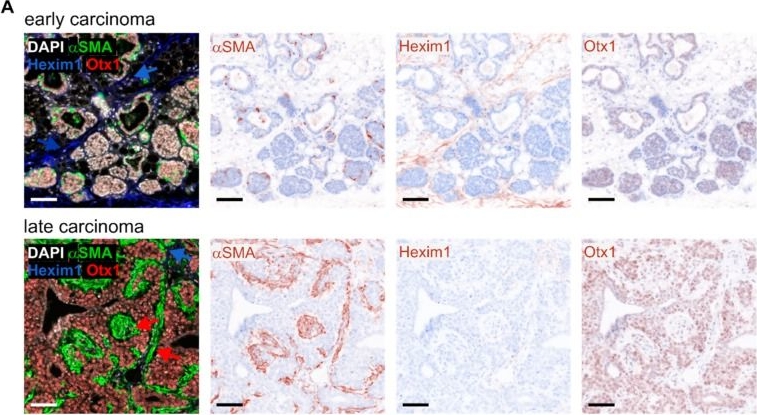 Fig.6.A showing Immunohistochemistry in a Mus musculus (House mouse) sample from the publication: Phenotypic Plasticity of Fibroblasts during Mammary Carcinoma Development.