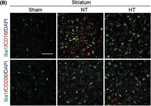 Fig.4.B showing Immunohistochemistry-immunofluorescence in a Mus musculus (House mouse) sample from the publication: Selective brain hypothermia attenuates focal cerebral ischemic injury and improves long-term neurological outcome in aged female mice.