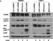 Fig.1.A showing Western Blotting in a Homo sapiens (Human) sample from the publication: CHIP/STUB1 Ubiquitin Ligase Functions as a Negative Regulator of ErbB2 by Promoting Its Early Post-Biosynthesis Degradation.