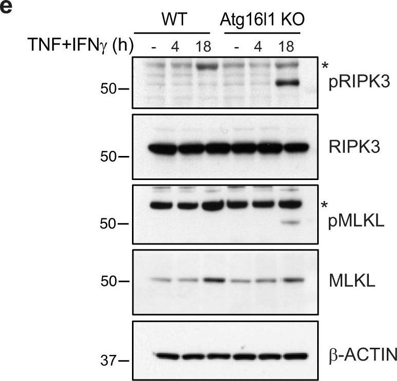 Fig.5.E showing Western Blotting from the publication: Tumor-intrinsic expression of the autophagy gene Atg16l1 suppresses anti-tumor immunity in colorectal cancer.