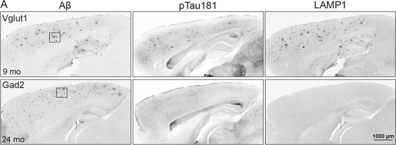 Fig.7.A showing Immunohistochemistry in a Mus musculus (House mouse) sample from the publication: Neuronal subtype governs amyloid structure, cellular response, and cognitive outcome in genetically targeted APP mouse models.